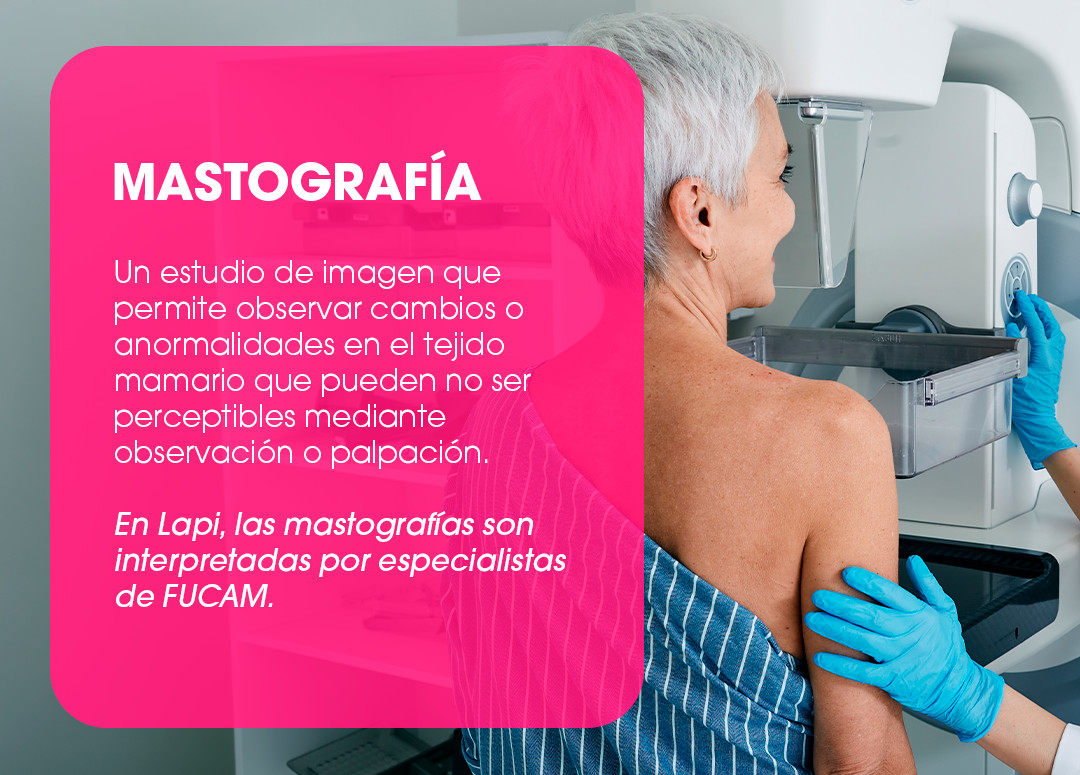 Mastografía. Un estudio de imagen que permite observar cambios o anormalidades en el tejido mamario que pueden no ser perceptibles mediante observación o palpación. En Lapi, las mastografías son interpretadas por especialistas de FUCAM.
