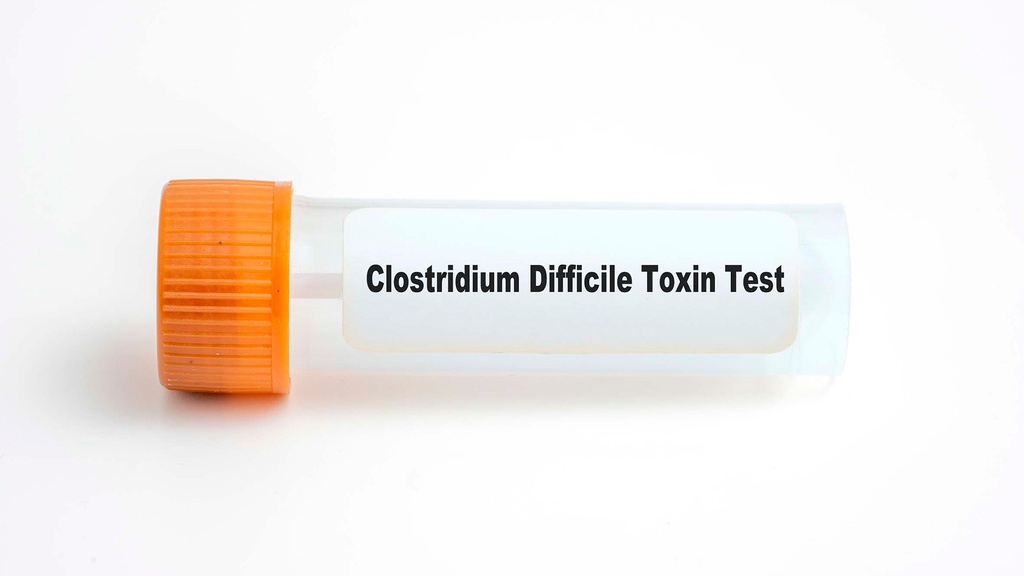 Toxina A y B de Clostridium difficile