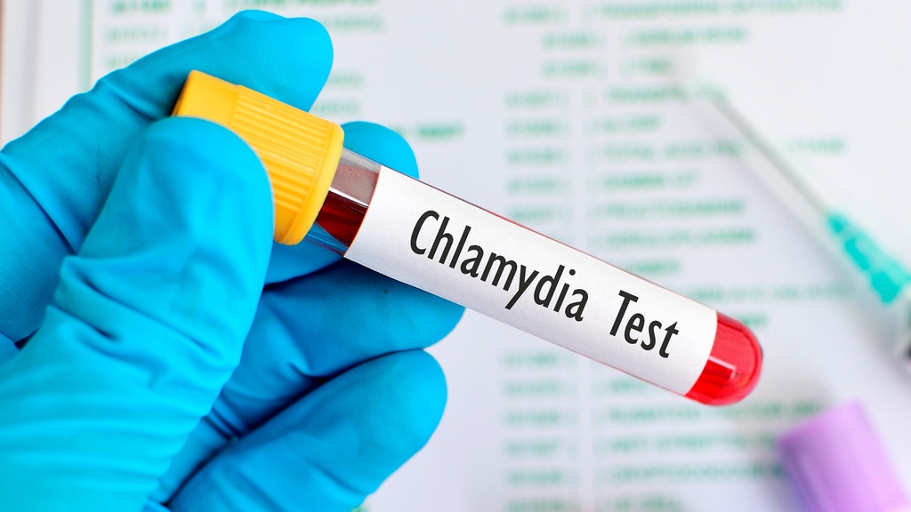 Chlamydia (Detección de antígeno)