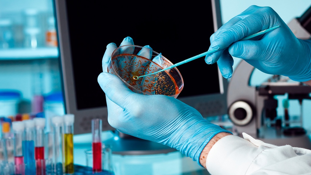 Cultivo de Secreción