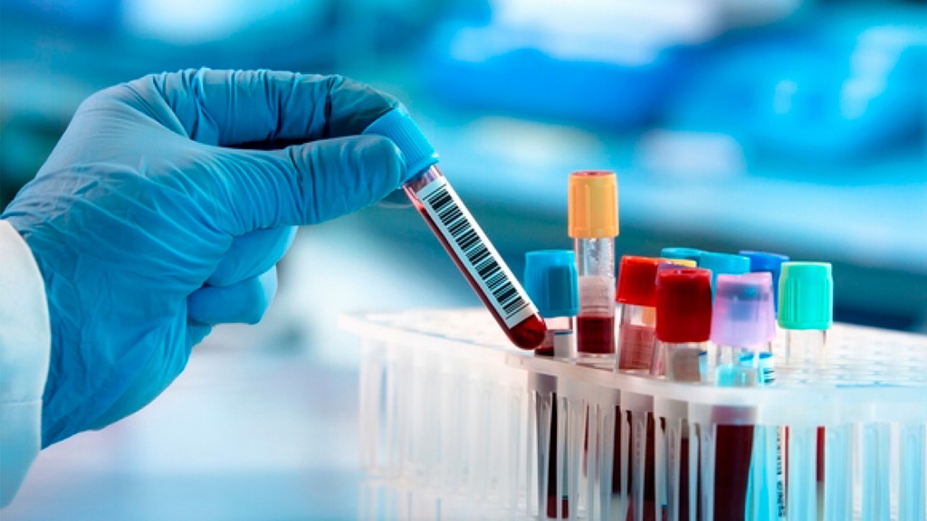 Dehidroepiandrosterona Sulfatada (DHEA - SO4)