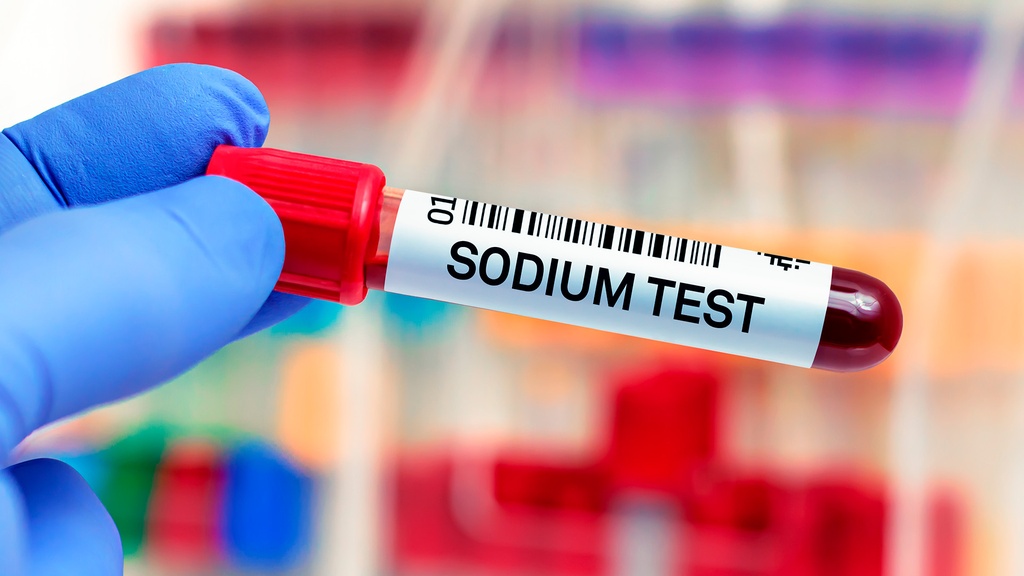 Electrolitos Séricos (Na, K, Cl)