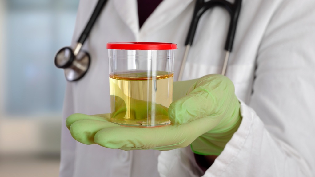 Electrolitos en Orina Ocasional