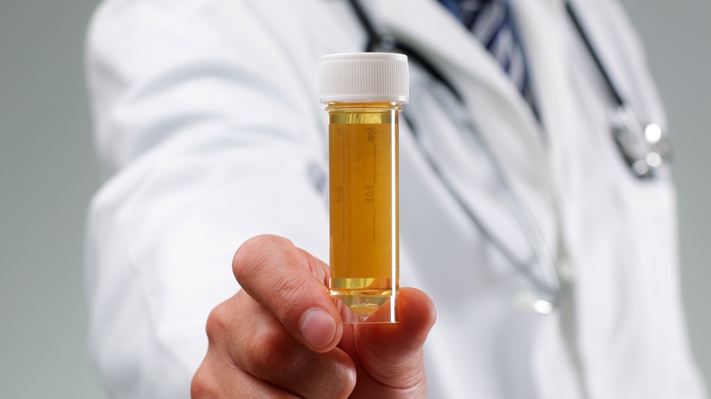 Electrolitos en Orina de 24 h