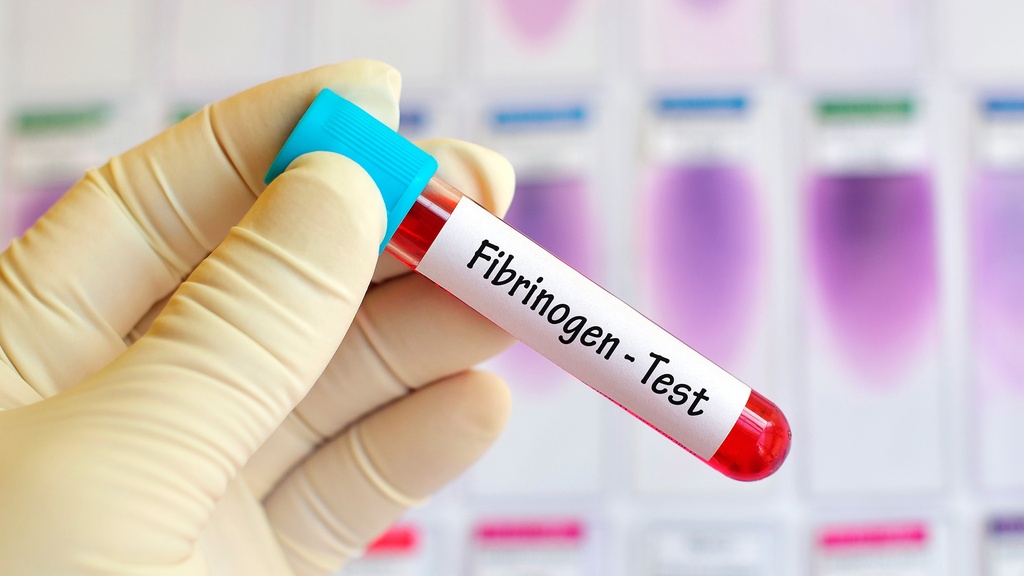 Fibrinógeno