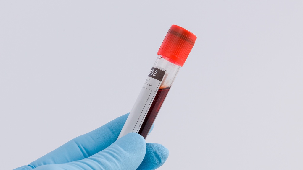 FibroTest - ActiTest