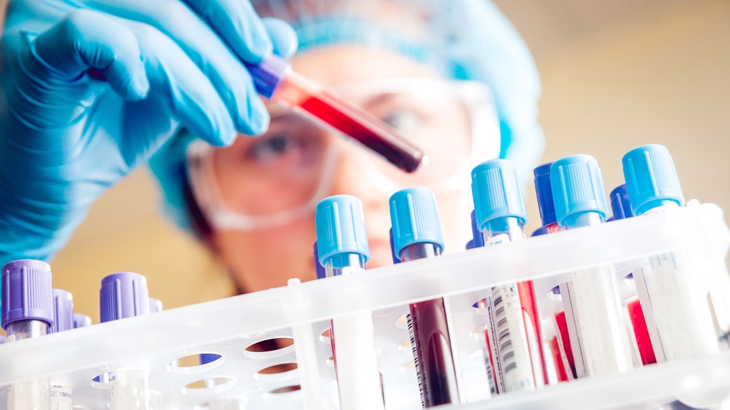 Perfil Coagulación Seguimiento