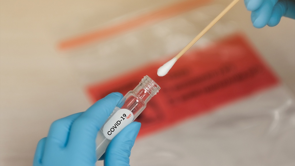 Perfil Indicadores Tempranos de Gravedad por Infección COVID-19