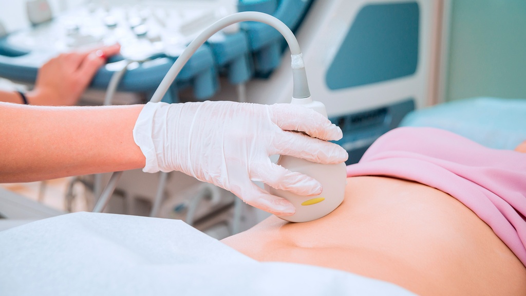 Ultrasonido Fosa Iliaca Derecha