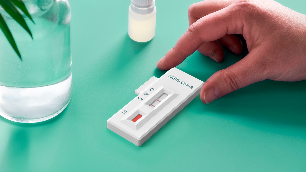 SARS-CoV-2 IgG e IgM