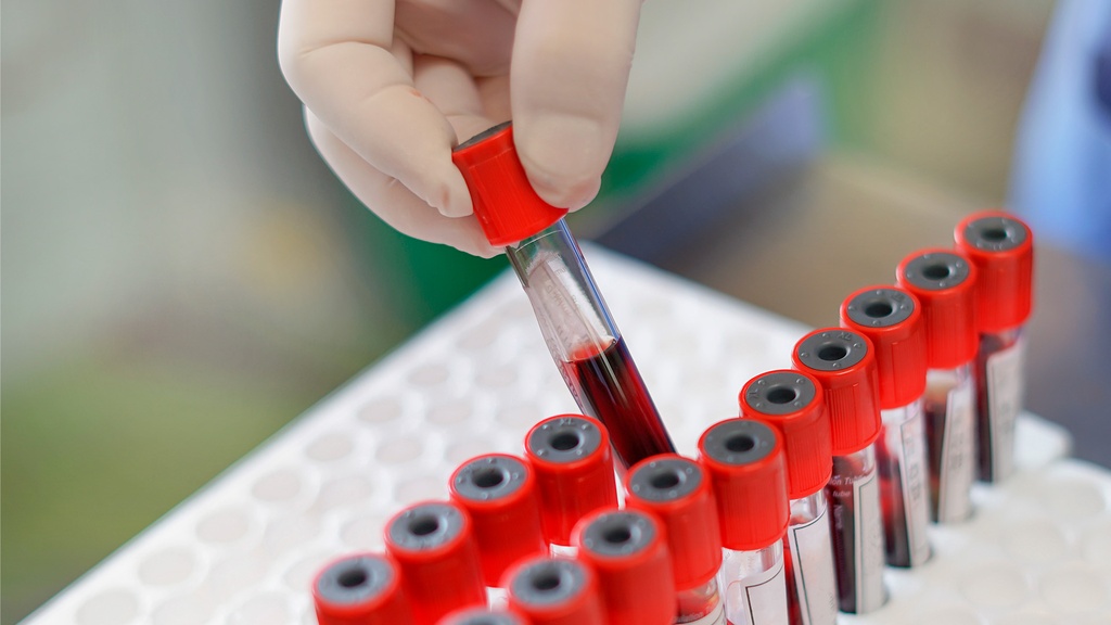 Tamiz Metabólico Diabético Gestacional