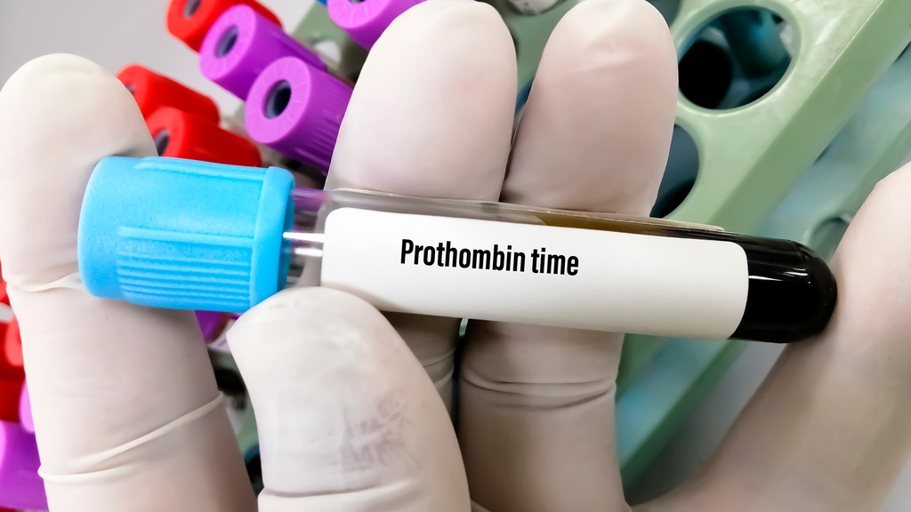 Tiempo de Protrombina