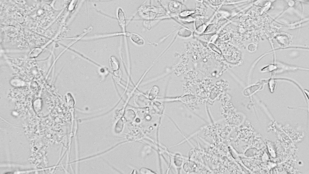 Espermatobioscopía (Seminograma)