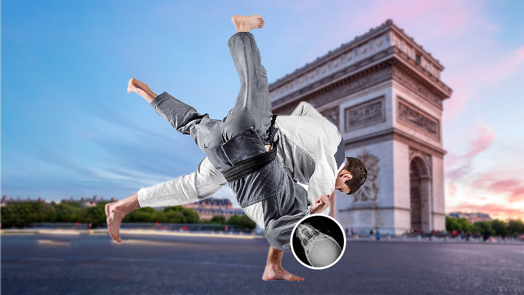 Rx Cráneo Hirtz (Base de Cráneo)