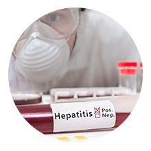 Perfil Hepatitis "A, B Y C"