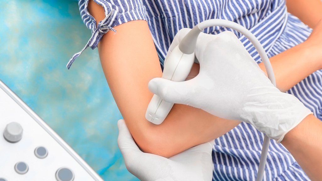 Doppler Arterial Y Venoso De Miembro Superior Derecho