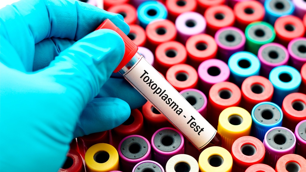 Ac. Anti - Toxoplasma IgM