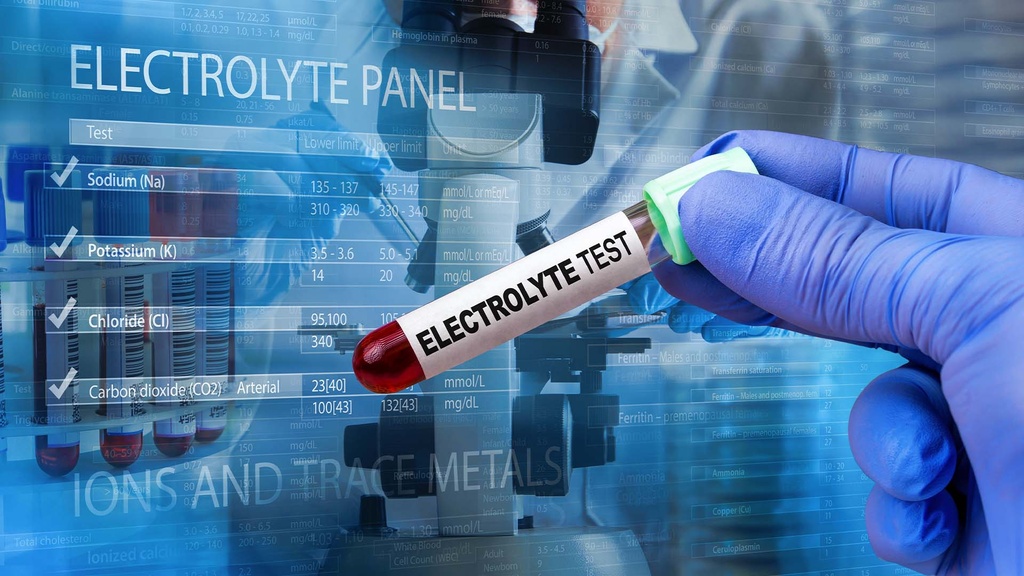 Perfil Electrolitos Completo (6)