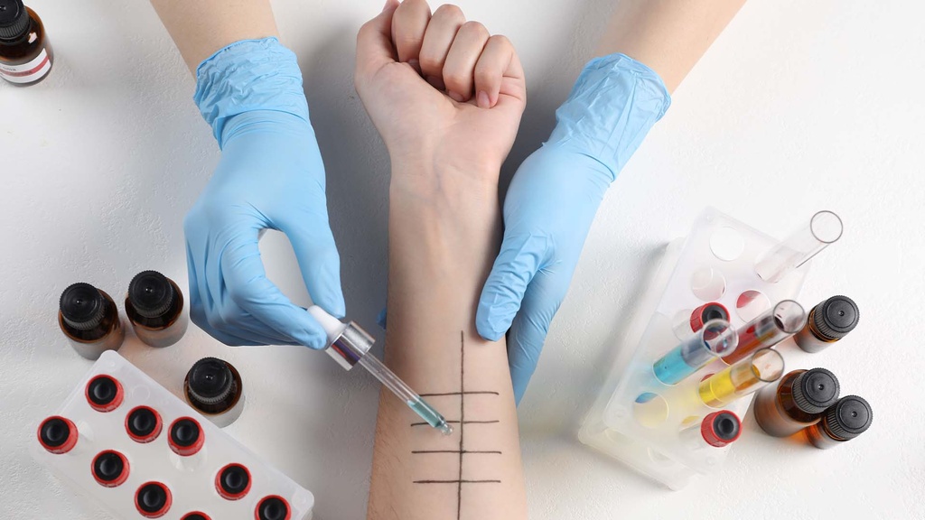 Perfil de Alergia Alimenticia (IgE)