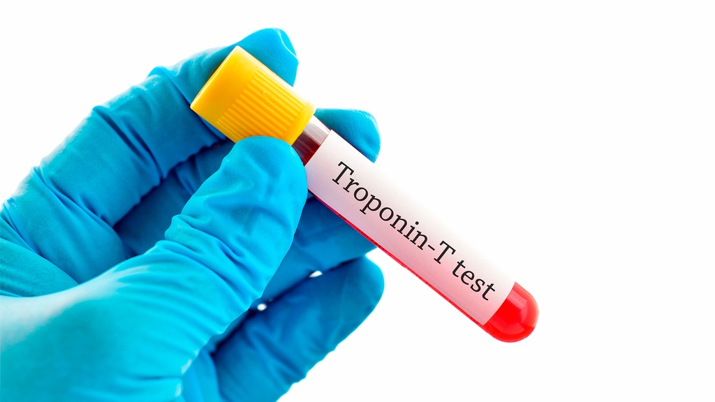 Troponina T