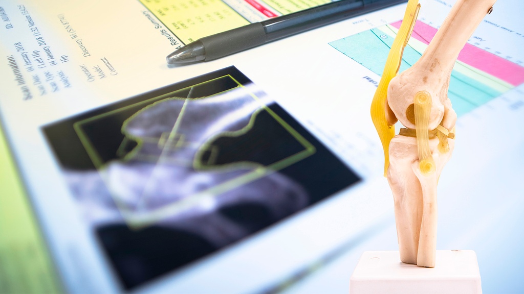 Densitometría Rodilla Ortopédica