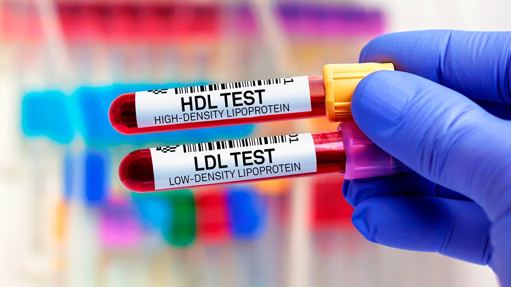 Lipoproteínas HDL / LDL
