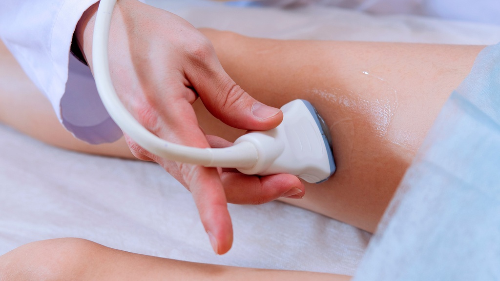 Doppler Venoso Bilateral De Miembros Inferiores