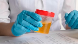 [DEPCRE2] Depuración de Creatinina en Orina de 24 h