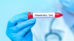 [VITB12] Vitamina B - 12
