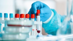 [INSULP] Insulina Post.-Prandial 2 hrs.